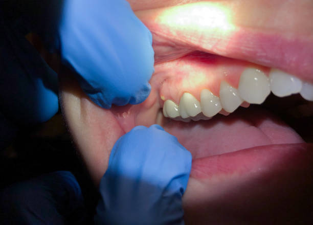 Best Urgent Tooth Repair  in Woodhaven, MI